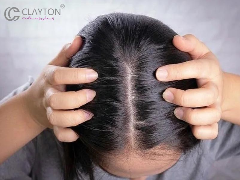 محصولات طبیعی برای کاهش چربی مو