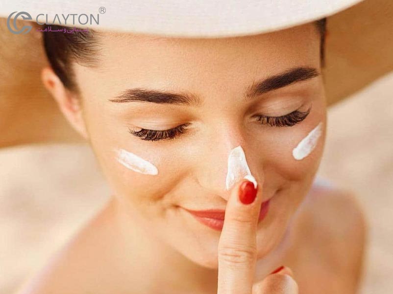 اهمیت سایه‌بان در روزهای آفتابی