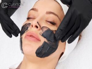 ترکیب مواد تشکیل‌دهنده ماسک زغال